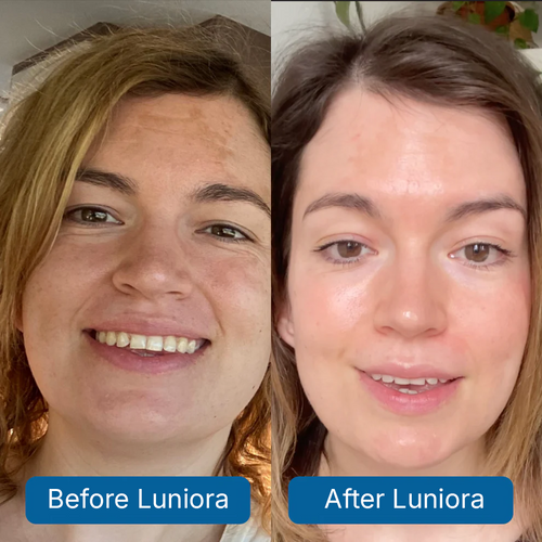 8D Hyaluronic Acid + PDRN Plump Serum