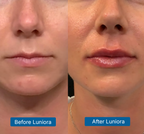8D Hyaluronic Acid + PDRN Plump Serum